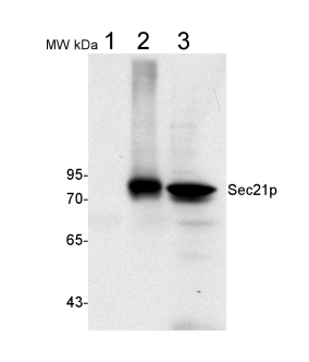 Western blot using anti-Sec21p